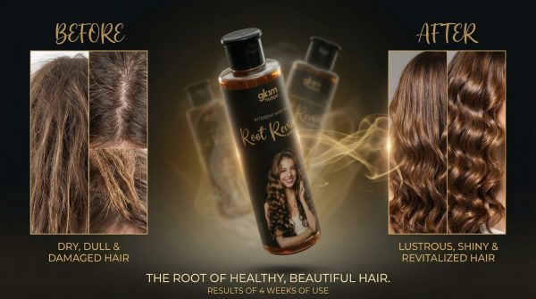 Root Revival Hair Oil for Hair Growth & Anti Hair Fall Formula